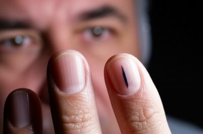 Unhas Reveladoras: 7 Sinais de Alerta Que Você Ignora (e Deveria!)